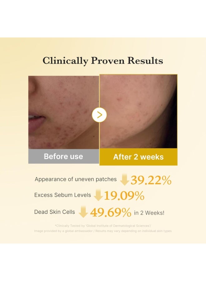 Medicube Kojic Acid Turmeric Clarifying Toner Pad for Troubled Skin & Use After Spot Care | Soothing & Calming with Kojic Acid, Turmeric, Niacinamide, and Glycolic Acid | Korean Skin Care, 70 Pads - Image 4